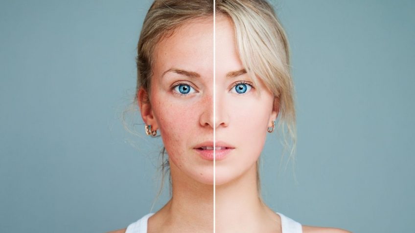  Bioderma sensibio ds krema je pravo rešenje za crvenilo!