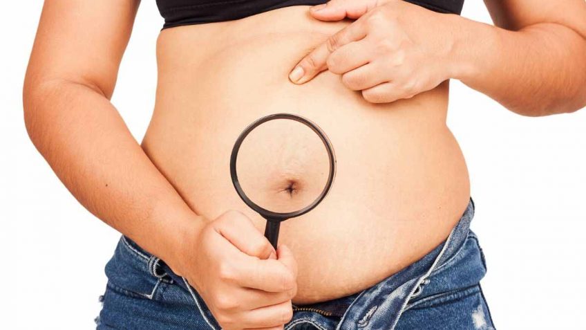  Imate strije?Probajte Hedera Vita buter sa arganom i vanilom