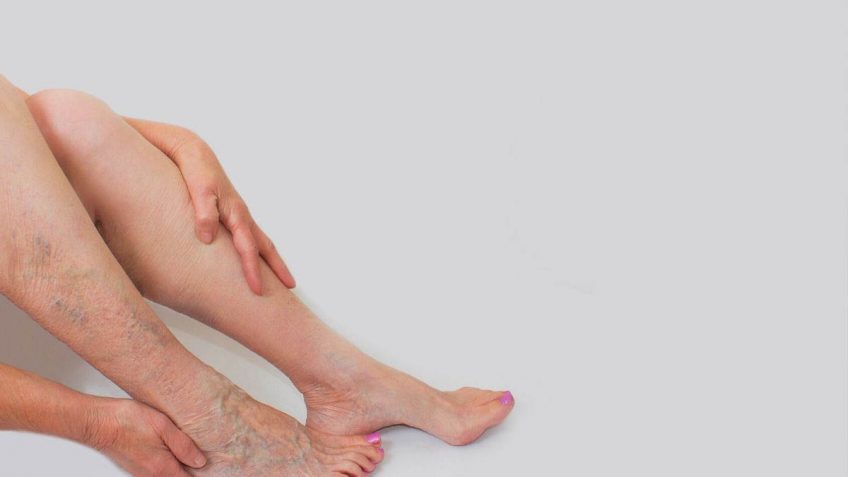  Najbolji gelovi za vene koji definitivno pomažu!