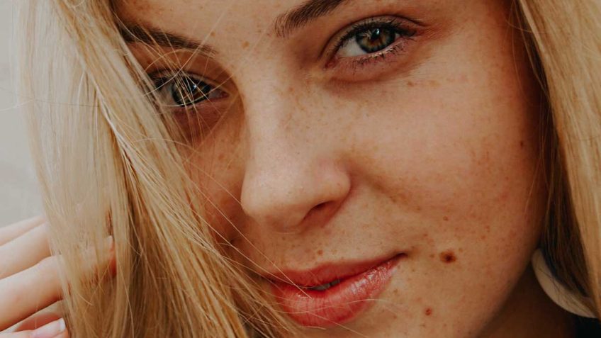  Antiflek forte krema kao magično rešenje za fleke: da ili ne!