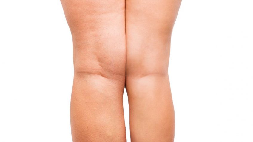  Da li je Krauterhof anticelulit gel najbolji gel protiv celulita!