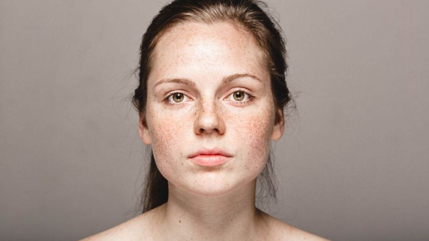  Najbolje kreme protiv hiperpigmentacije: 9 preporuka!