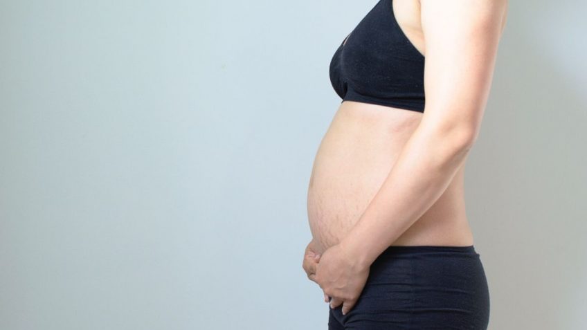  Koliko je zaista efikasno Eucerin ulje protiv strija!