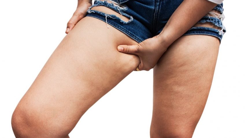  Kako skinuti celulit na nogama? Ovo pomaže!