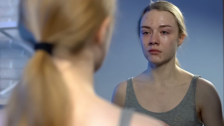  Pubertetske bubuljice i kozmetika protiv njih