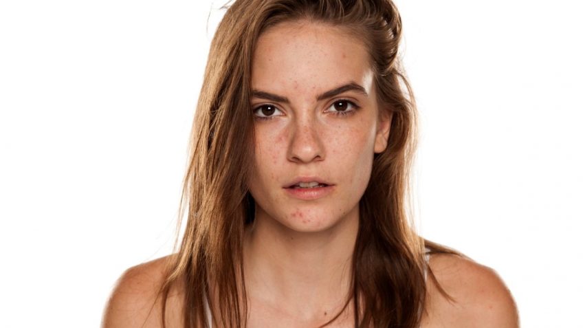 Biologique Recherche losion p50W protiv akni