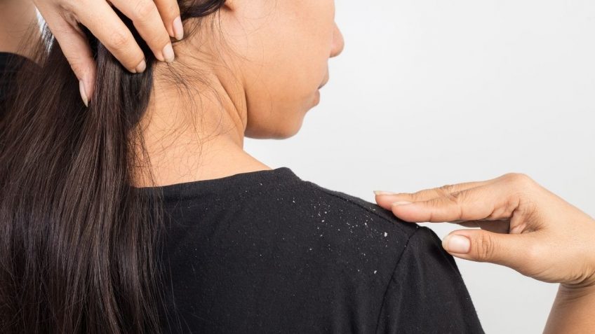  Iskustva za Eucerin šampon protiv suve peruti!