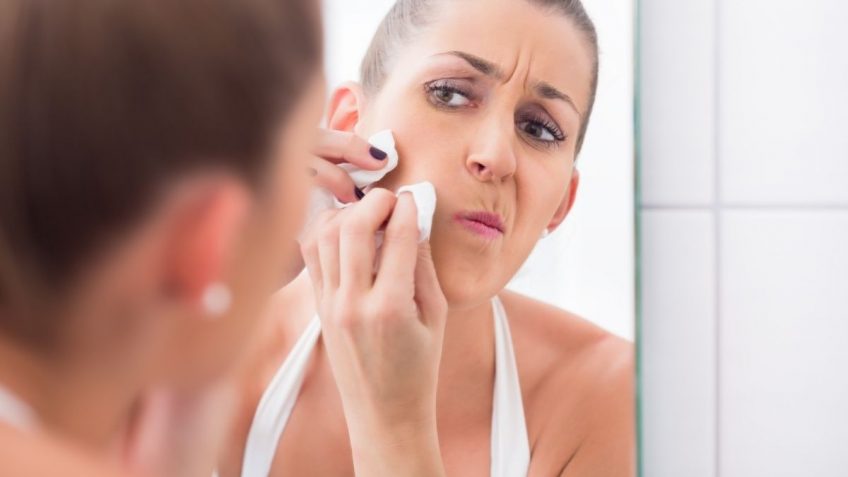  Kako ukloniti mitisere sa lica, dubinski i bezbedno!