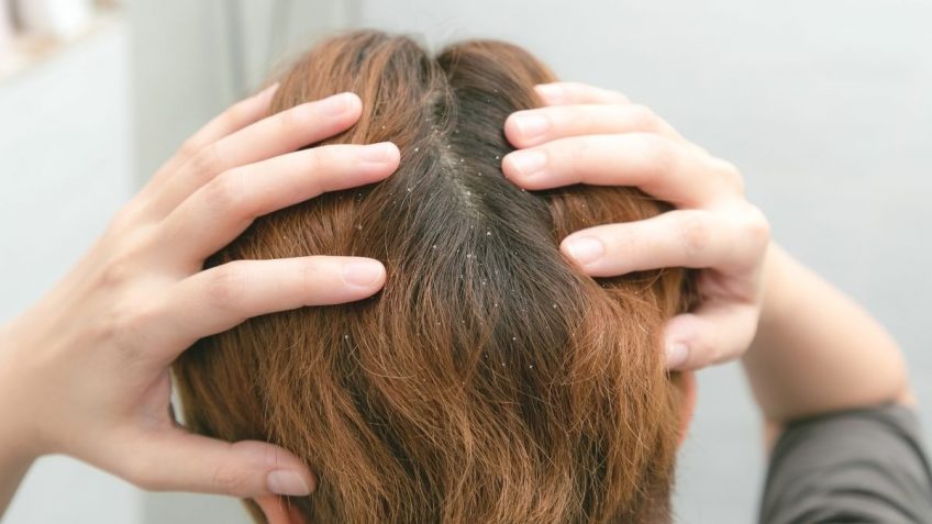  Eucerin šampon protiv masne peruti i uporne seboreje! Iskustva!