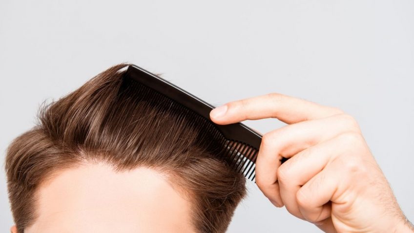  Da li Rigenforte šampon protiv peruti čisti perut?Otkrivamo!