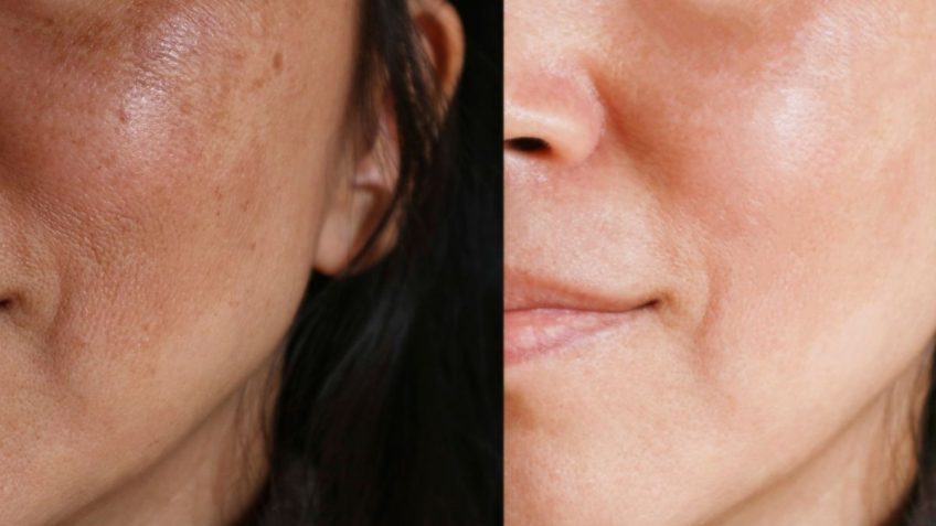  Dr Colić krema protiv fleka recenzija i iskustva