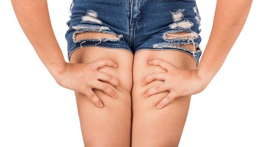  8 najboljih preparata protiv celulita kod nas!