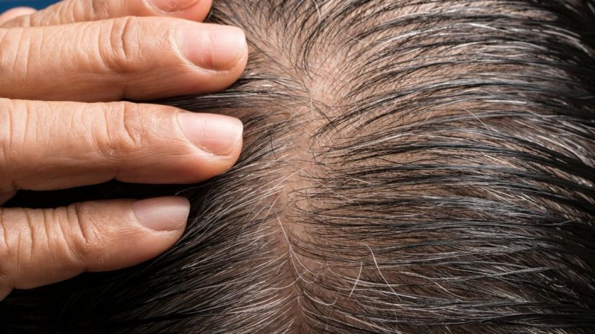  Ne ignorišite opadanje kose sa korenom – može eskalirati!