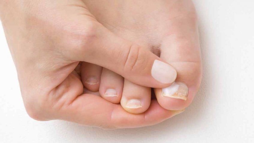  Izdvajamo 7 dobrih krema za gljivice na noktima!