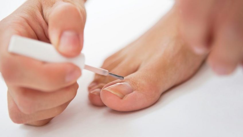  Mycosan za nokte: da li zaista sprečava gljivice!?