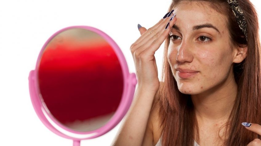  7 najboljih krema za bubuljice: pregled i preporuka